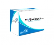 ELISA Test Kits For Research